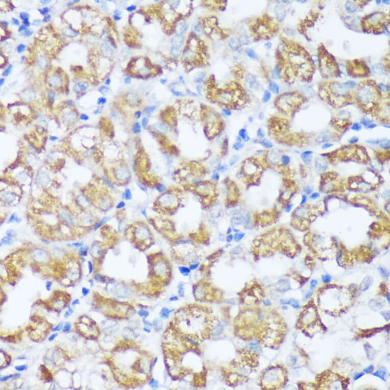 Immunohistochemistry - Anti-Beclin 1 Antibody (A307235) - Antibodies.com