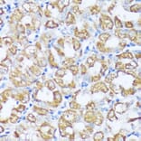 Immunohistochemistry - Anti-Beclin 1 Antibody (A307235) - Antibodies.com