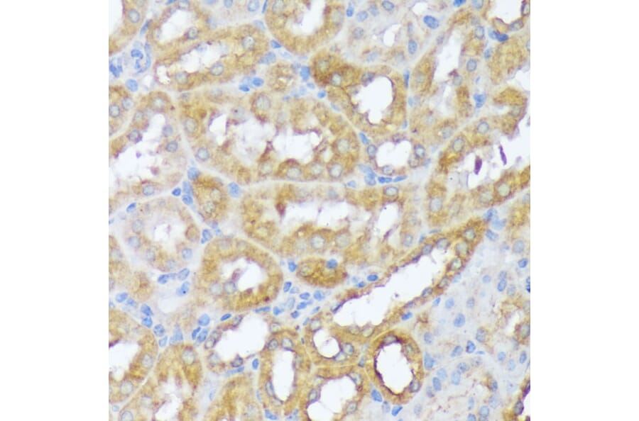 Immunohistochemistry - Anti-Beclin 1 Antibody (A307235) - Antibodies.com