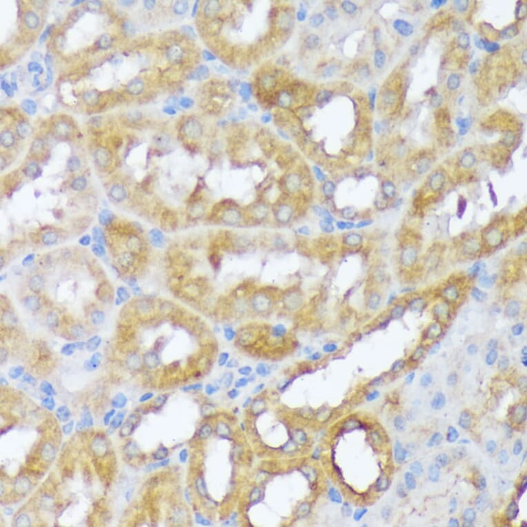 Immunohistochemistry - Anti-Beclin 1 Antibody (A307235) - Antibodies.com