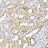 Immunohistochemistry - Anti-Beclin 1 Antibody (A307235) - Antibodies.com
