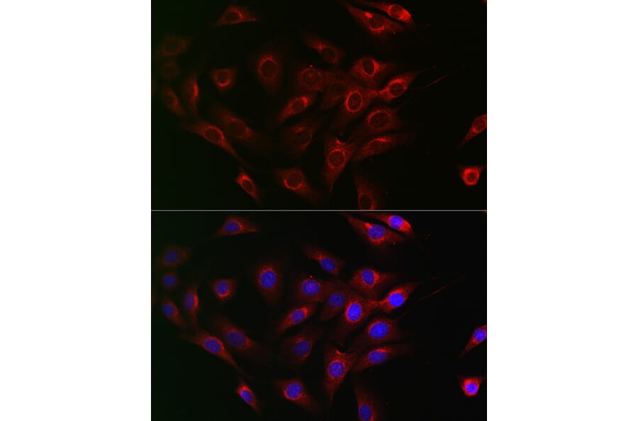 Immunofluorescence - Anti-Beclin 1 Antibody (A307235) - Antibodies.com