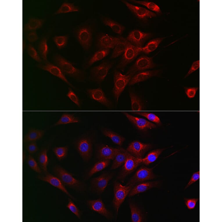 Immunofluorescence - Anti-Beclin 1 Antibody (A307235) - Antibodies.com