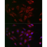 Immunofluorescence - Anti-Beclin 1 Antibody (A307235) - Antibodies.com