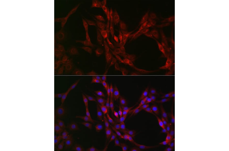 Immunofluorescence - Anti-Beclin 1 Antibody (A307235) - Antibodies.com