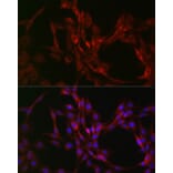 Immunofluorescence - Anti-Beclin 1 Antibody (A307235) - Antibodies.com