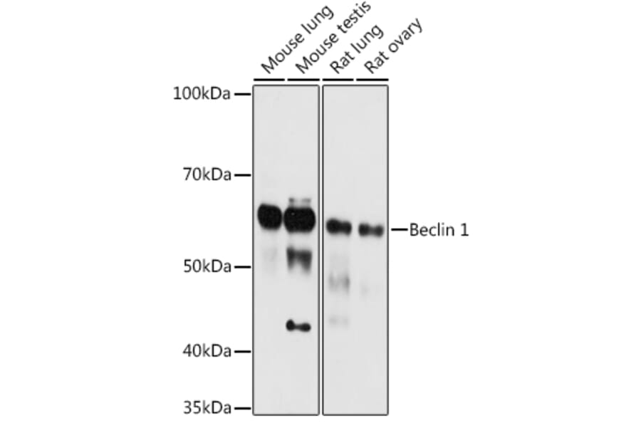 Western Blot - Anti-Beclin 1 Antibody (A307236) - Antibodies.com
