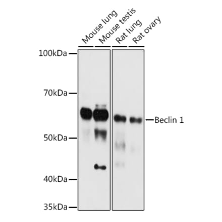 Western Blot - Anti-Beclin 1 Antibody (A307236) - Antibodies.com