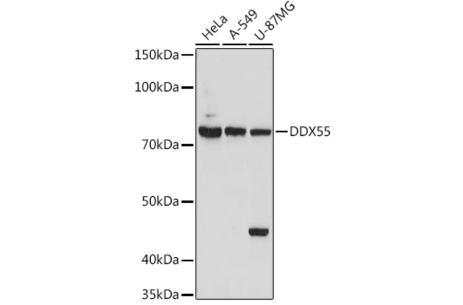 Western Blot - Anti-DDX55 Antibody (A307238) - Antibodies.com
