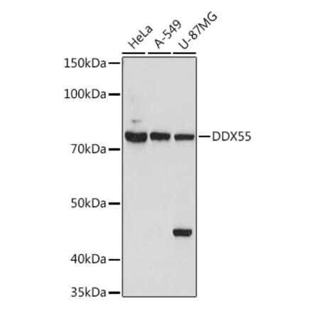 Western Blot - Anti-DDX55 Antibody (A307238) - Antibodies.com