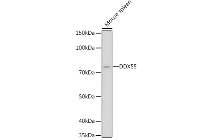 Western Blot - Anti-DDX55 Antibody (A307238) - Antibodies.com