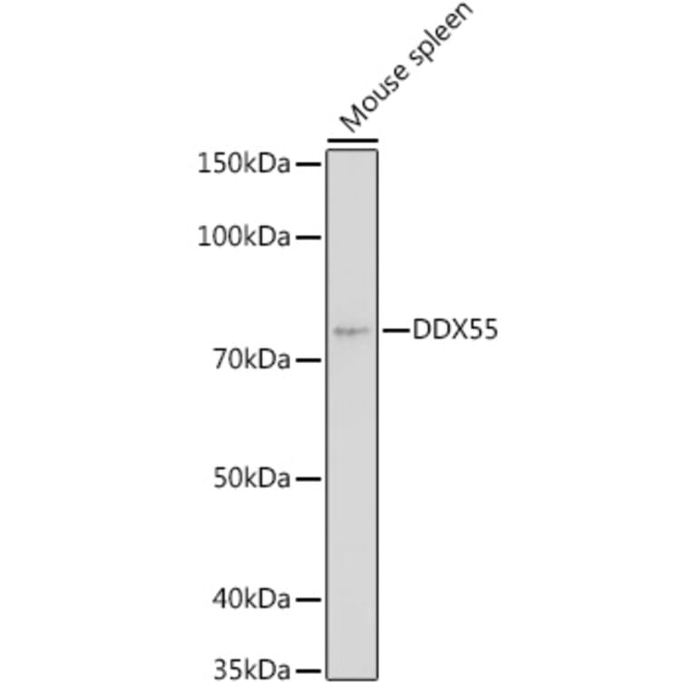 Western Blot - Anti-DDX55 Antibody (A307238) - Antibodies.com