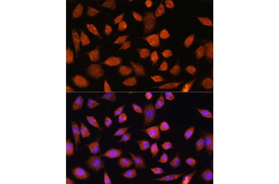 Immunofluorescence - Anti-PLD3 Antibody (A307239) - Antibodies.com