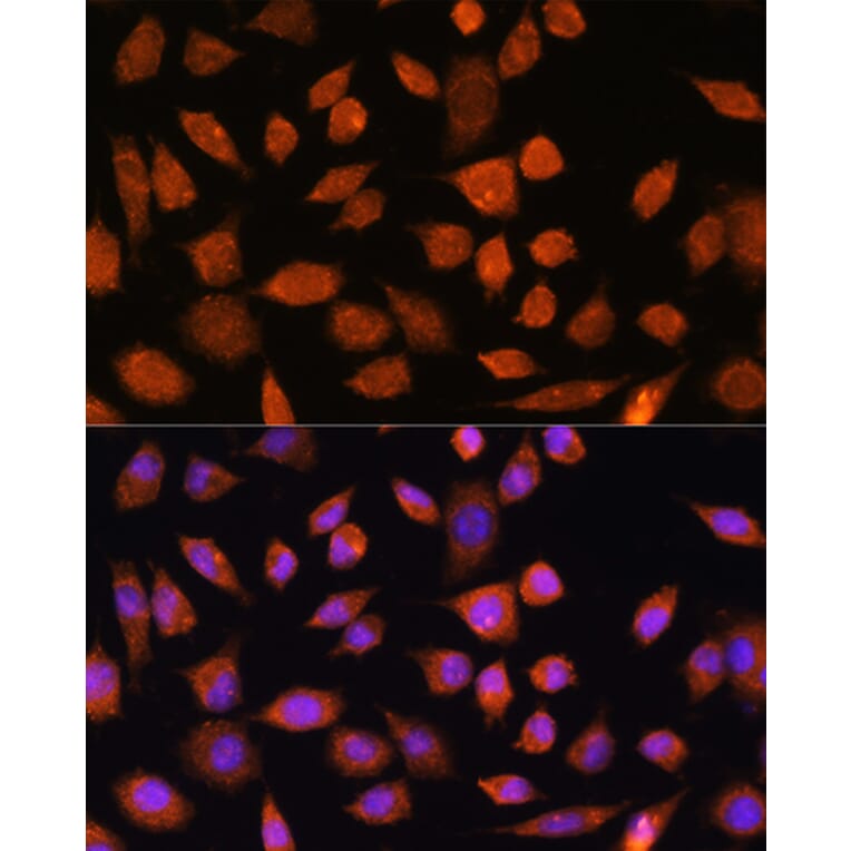 Immunofluorescence - Anti-PLD3 Antibody (A307239) - Antibodies.com