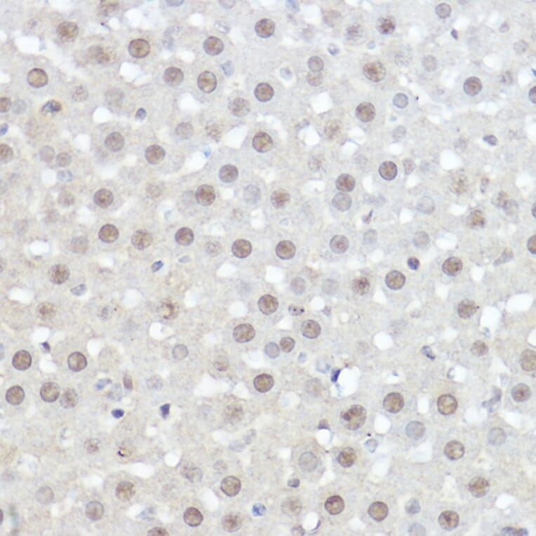 Immunohistochemistry - Anti-AHNAK Antibody (A307240) - Antibodies.com