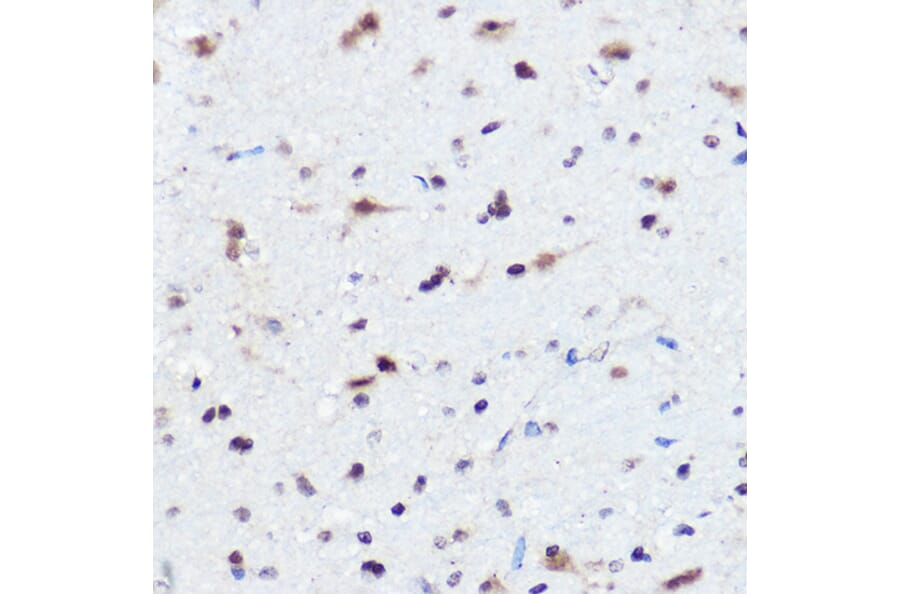 Immunohistochemistry - Anti-AHNAK Antibody (A307240) - Antibodies.com