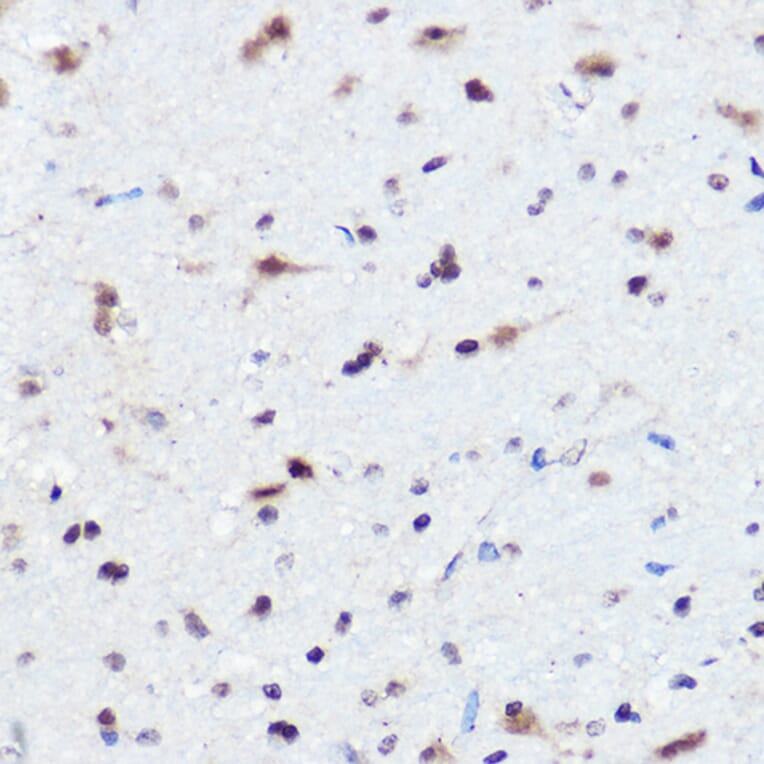 Immunohistochemistry - Anti-AHNAK Antibody (A307240) - Antibodies.com