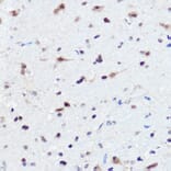 Immunohistochemistry - Anti-AHNAK Antibody (A307240) - Antibodies.com