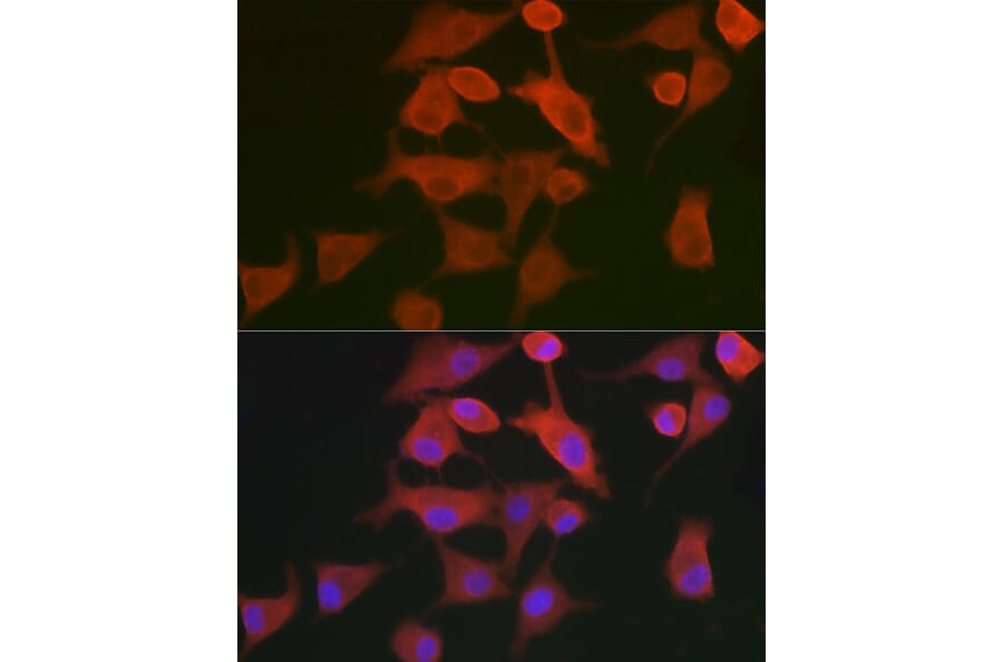 Immunofluorescence - Anti-AHNAK Antibody (A307240) - Antibodies.com