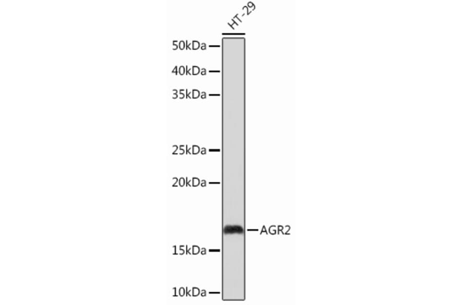 Western Blot - Anti-AGR2 Antibody [ARC0709] (A307241) - Antibodies.com