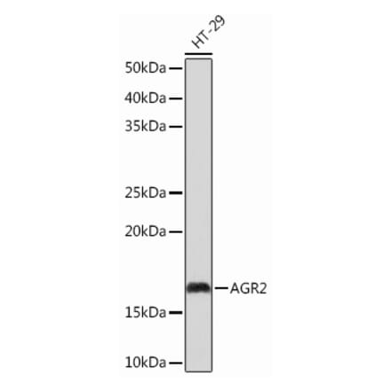 Western Blot - Anti-AGR2 Antibody [ARC0709] (A307241) - Antibodies.com