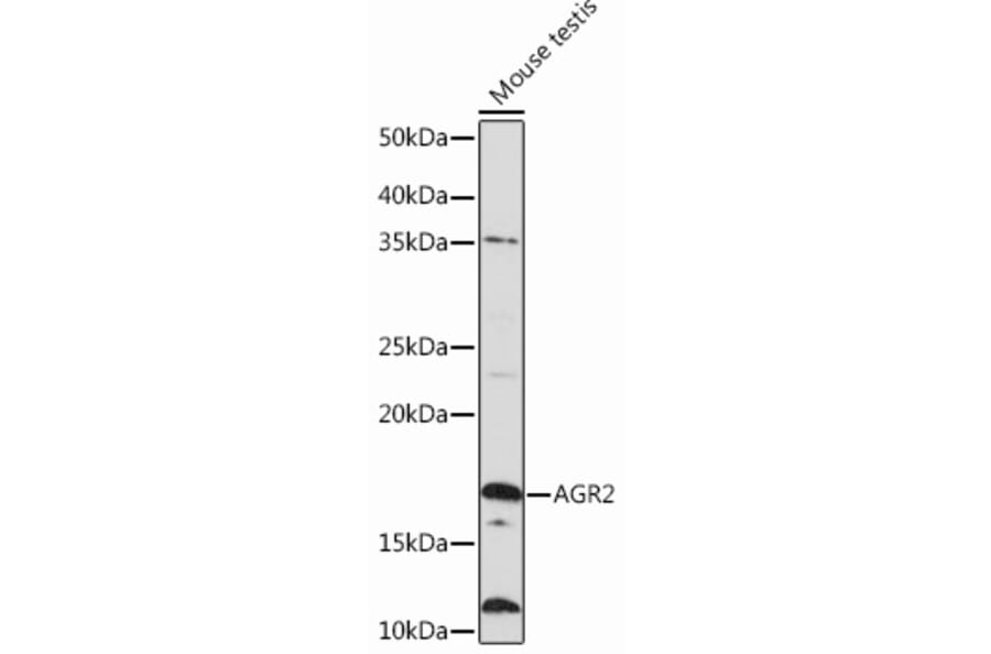 Western Blot - Anti-AGR2 Antibody [ARC0709] (A307241) - Antibodies.com