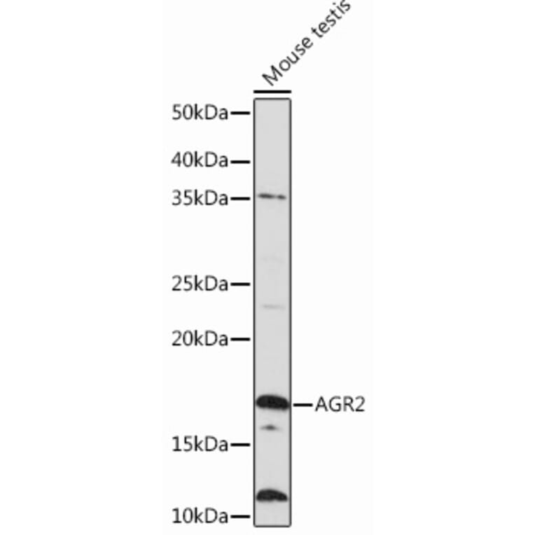 Western Blot - Anti-AGR2 Antibody [ARC0709] (A307241) - Antibodies.com