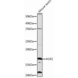 Western Blot - Anti-AGR2 Antibody [ARC0709] (A307241) - Antibodies.com