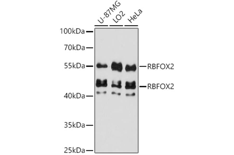 Western Blot - Anti-Fox2/RBM9 Antibody (A307242) - Antibodies.com