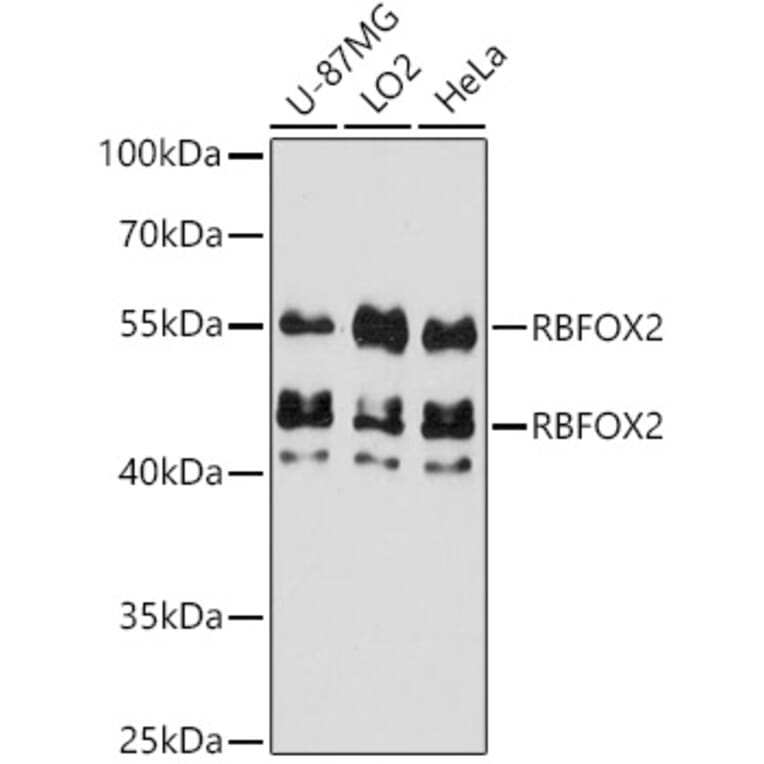 Western Blot - Anti-Fox2/RBM9 Antibody (A307242) - Antibodies.com