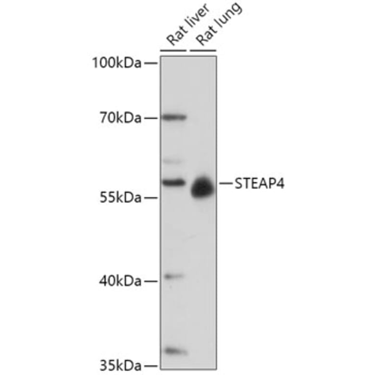 Western Blot - Anti-STEAP4 Antibody (A307243) - Antibodies.com