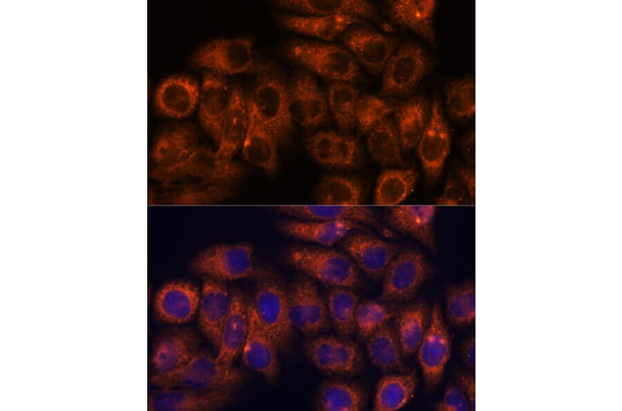 Immunofluorescence - Anti-STEAP4 Antibody (A307243) - Antibodies.com
