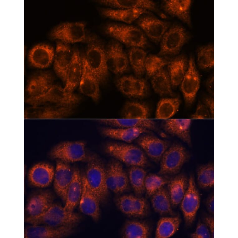 Immunofluorescence - Anti-STEAP4 Antibody (A307243) - Antibodies.com