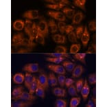 Immunofluorescence - Anti-STEAP4 Antibody (A307243) - Antibodies.com