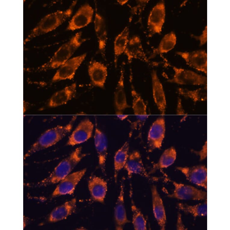 Immunofluorescence - Anti-STEAP4 Antibody (A307243) - Antibodies.com