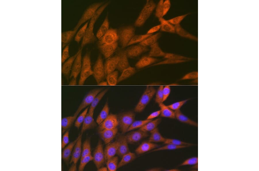 Immunofluorescence - Anti-14-3-3 Theta/Tau Antibody [ARC1358] (A307244) - Antibodies.com