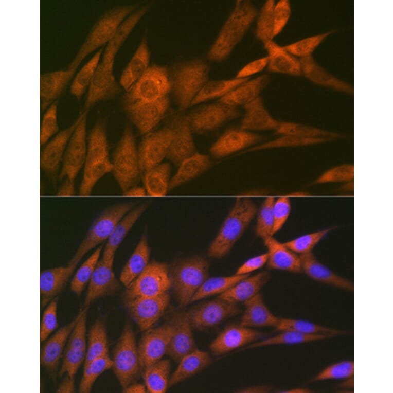 Immunofluorescence - Anti-14-3-3 Theta/Tau Antibody [ARC1358] (A307244) - Antibodies.com