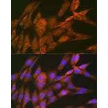 Immunofluorescence - Anti-14-3-3 Theta/Tau Antibody [ARC1358] (A307244) - Antibodies.com