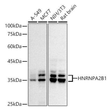 Western Blot - Anti-hnRNP A2B1 Antibody (A307245) - Antibodies.com
