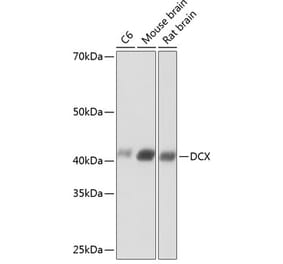 Western Blot - Anti-Doublecortin Antibody [ARC0380] (A307246) - Antibodies.com