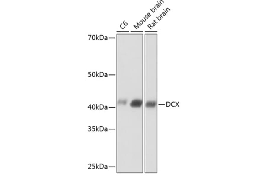 Western Blot - Anti-Doublecortin Antibody [ARC0380] (A307246) - Antibodies.com