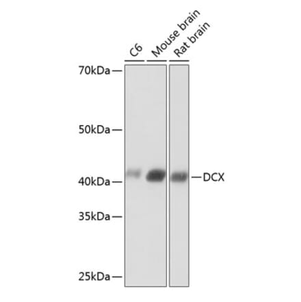 Western Blot - Anti-Doublecortin Antibody [ARC0380] (A307246) - Antibodies.com