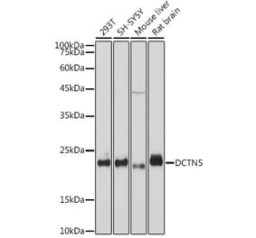 Western Blot - Anti-DCTN5 Antibody [ARC2412] (A307247) - Antibodies.com