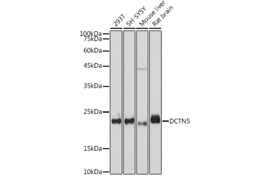 Western Blot - Anti-DCTN5 Antibody [ARC2412] (A307247) - Antibodies.com