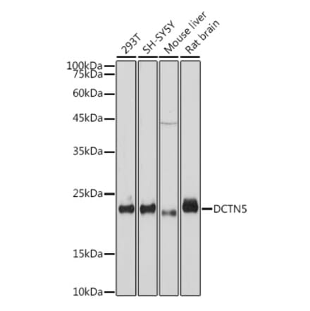 Western Blot - Anti-DCTN5 Antibody [ARC2412] (A307247) - Antibodies.com