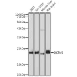 Western Blot - Anti-DCTN5 Antibody [ARC2412] (A307247) - Antibodies.com