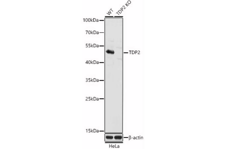 Western Blot - Anti-TDP2 Antibody (A307248) - Antibodies.com