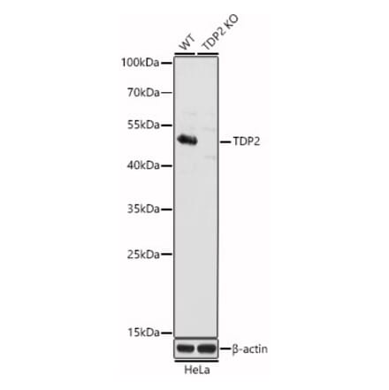 Western Blot - Anti-TDP2 Antibody (A307248) - Antibodies.com