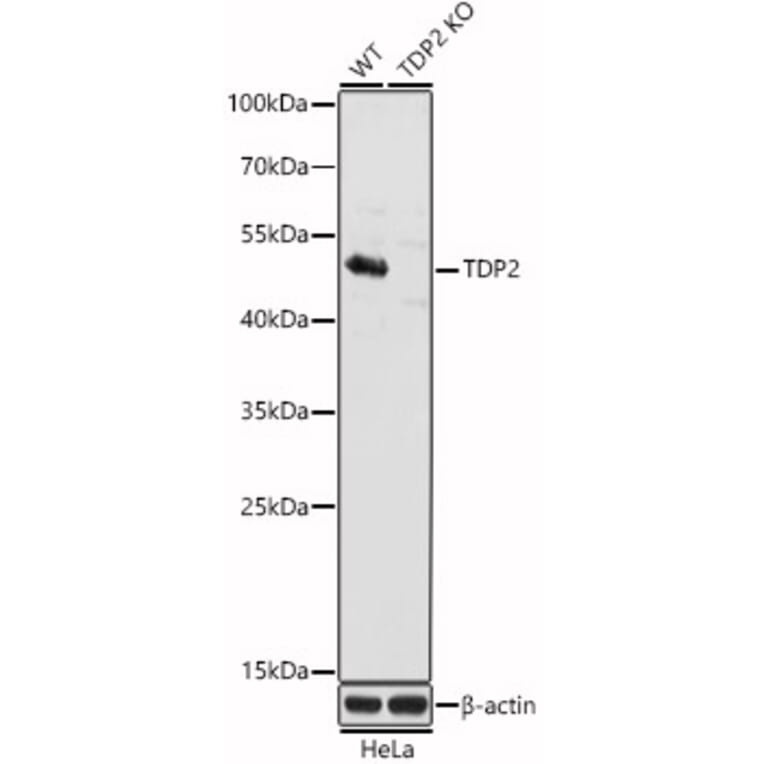 Western Blot - Anti-TDP2 Antibody (A307248) - Antibodies.com