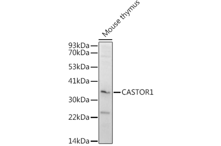 Western Blot - Anti-LOC652968 Antibody (A307249) - Antibodies.com